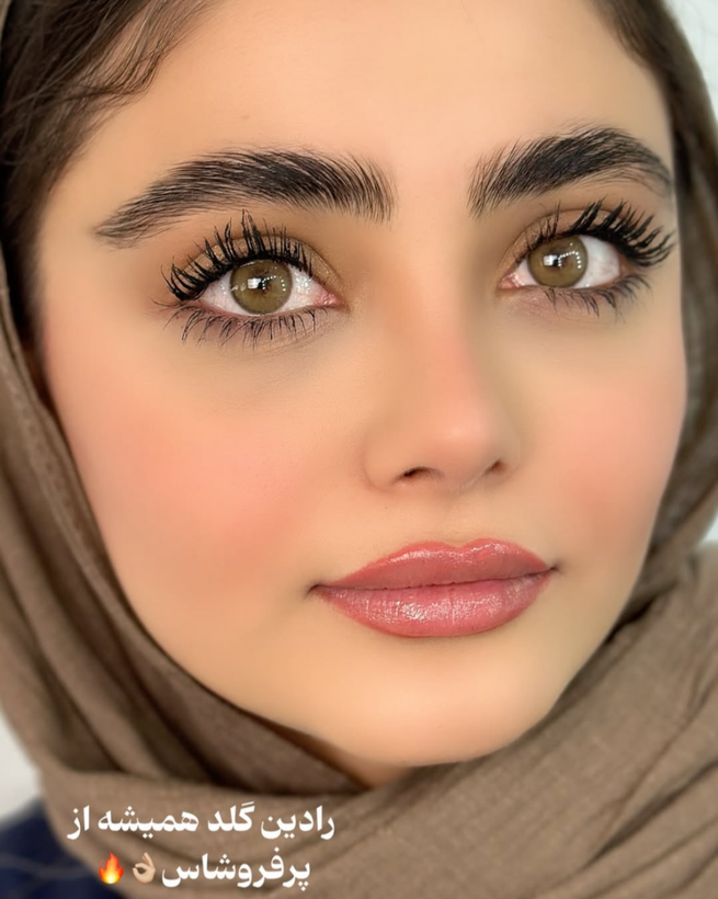 لنز چشم برند آیس کالر رنگ رادین گلد