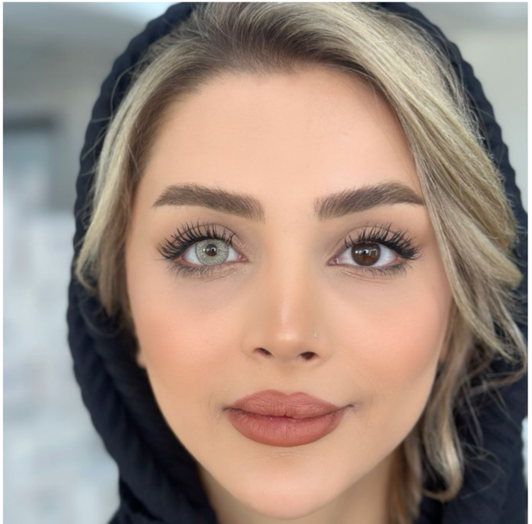لنز چشم برند آیس کالر رنگ آلوئه ورا